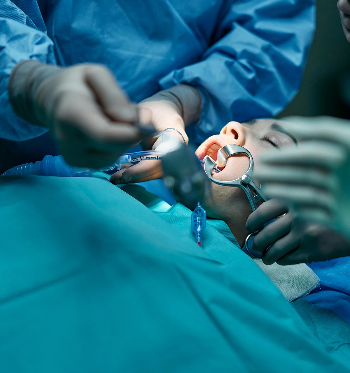 Dental Traumatic Injuries Family Dental and Advanced Implant Center