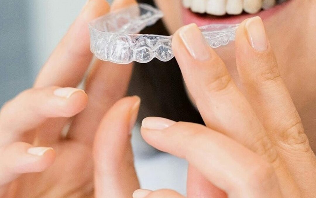 Invisalign®