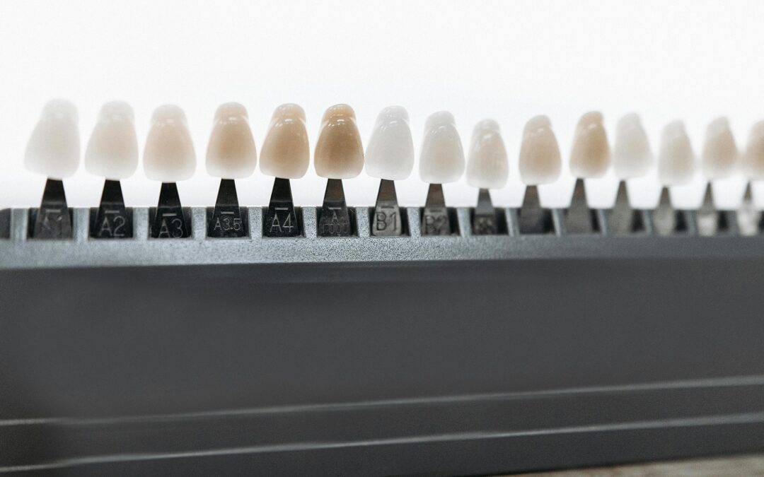 Restoring Your Smile With Custom Dental Crowns and Bridges