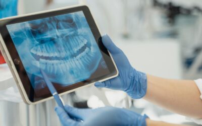 Revolutionizing Patient Care: The Impact of Advanced Dental Technologies