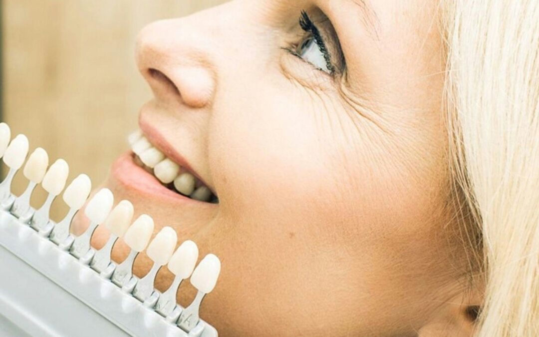 Restorative Dentistry Fillings Crowns and Bridges Explained